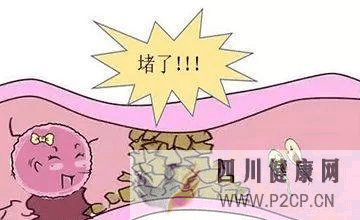 輸卵管堵塞和輸卵管走行扭曲一樣嗎？(圖1)