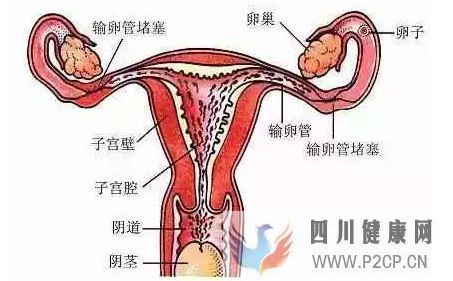 不孕不育輸卵管不孕,女性不孕的最大危害之一!(圖1)