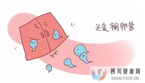 不孕不育輸卵管不孕,女性不孕的最大危害之一!(圖4)