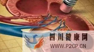 她患糖尿病2年就被診斷為糖尿病腎病晚期,你的糖尿病腎病預(yù)防工作做得好嗎(圖1) 她患糖尿病2年就被診斷為糖尿病腎病晚期,你的糖尿病腎病預(yù)防工作做得好嗎(圖1)