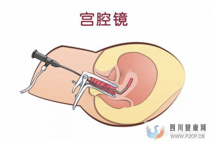 不孕癥的自我診斷(圖5)