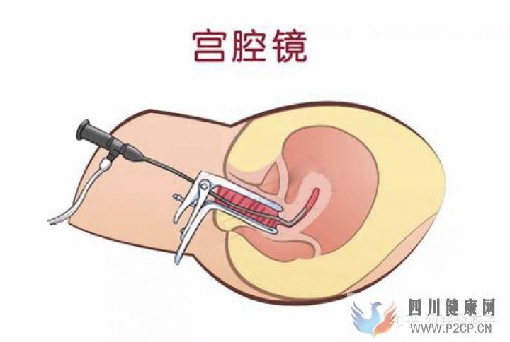 不孕癥的自我診斷(圖6)
