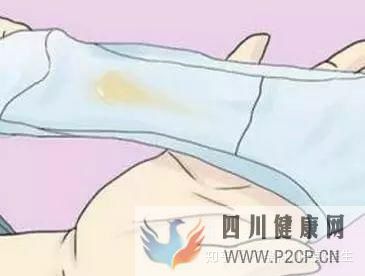 不孕癥有哪些常見癥狀(圖8)