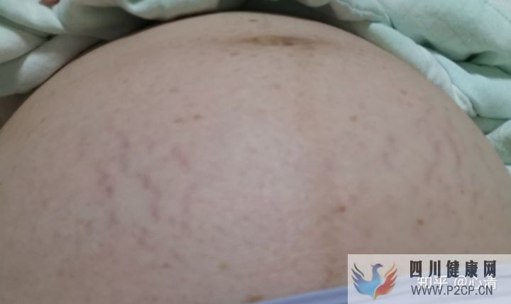 產科通關路懷孕、建檔、產檢、分娩全記錄(完結)(圖8) 產科通關路懷孕、建檔、產檢、分娩全記錄(完結)(圖8)