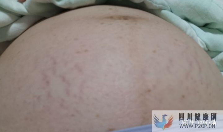 產科通關路懷孕、建檔、產檢、分娩全記錄(完結)(圖9) 產科通關路懷孕、建檔、產檢、分娩全記錄(完結)(圖9)