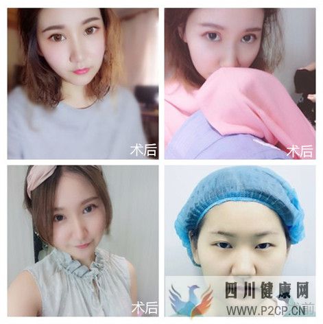 美容整形前一定要知道的美容整形知識(圖1)