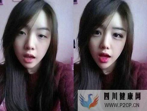美容整形前一定要知道的美容整形知識(圖4)