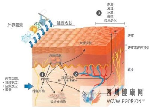 皮膚過敏,從原因到解決方案(圖13)