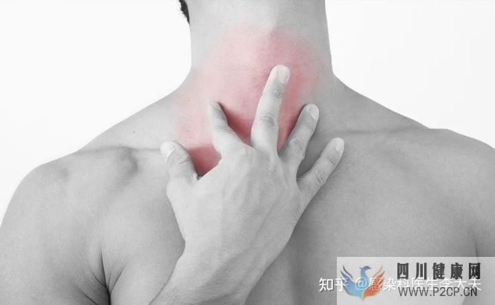 如果不幸感染“艾滋”,身體會有哪些癥狀(圖6)