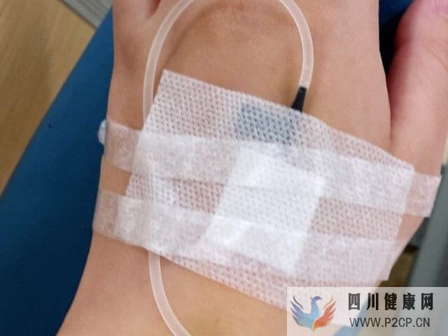 試管移植手術后輸液是保胎