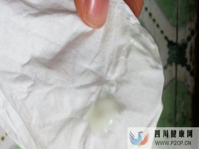 未著床胚胎流出體外會凝固型白帶
