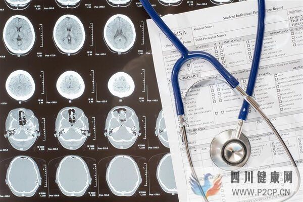 呼吸道病毒感染潮蔓延背后,CT正在被濫用?(圖4) 呼吸道病毒感染潮蔓延背后,CT正在被濫用?(圖4)
